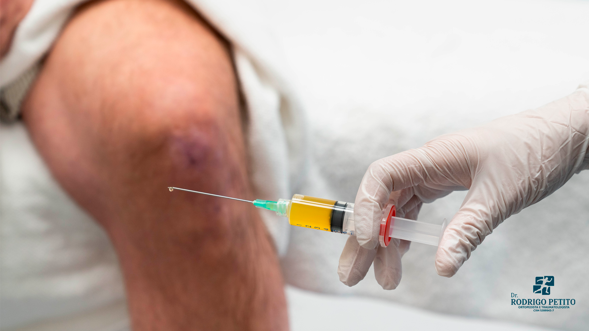 BP (1) - Dr. Rodrigo Petito - Ortopedista pós-graduado em Medicina do Exercício e do Esporte e em Intervenção em Dor